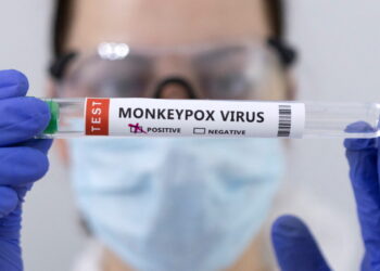 연구원이 원숭이두창 (Monkey Pox) 감염  테스트에서 양성 반응이 나온 결과물을 보여주고 있다. 사진 / 로이터