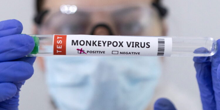 연구원이 원숭이두창 (Monkey Pox) 감염  테스트에서 양성 반응이 나온 결과물을 보여주고 있다. 사진 / 로이터