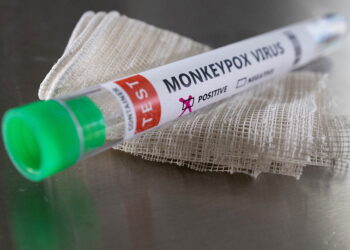 원숭이두창 감염 테스트 결과를 보여주는 튜브. 사진 / 로이터