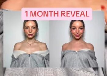 가는 어깨에 긴 목 '바비 보톡스' 화제