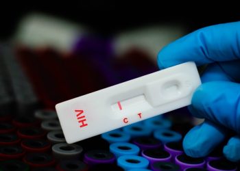 HIV 검사 키트. [출처 셔터스톡]