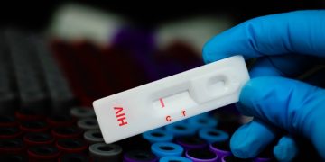 HIV 검사 키트. [출처 셔터스톡]