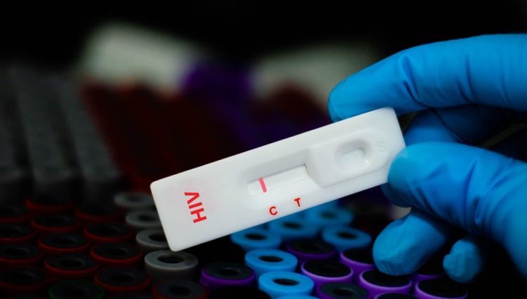 HIV 검사 키트. [출처 셔터스톡]