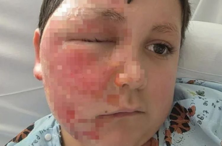 미국 9세 소년이 나도 큐브를 전자레인지에 돌렸다가 화상을 입는 사고가 발생했다. 시카고 선 타임즈