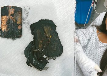 폭발한 보조배터리 잔해(왼쪽). 화상을 입은 애슐리 네벨. [인스타그램 캡처]