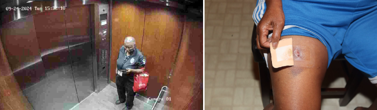 풀턴 검찰이 재판 과정에서 증거로 제시한 아파트 CCTV 영상 및 허벅지 상흔. 검찰은 CCTV에 찍힌 인물이 피해자를 살해한 직후의 용의자라고 주장했으며 허벅지 상처는 피해자와의 몸싸움으로 생긴 것이라고 했다.