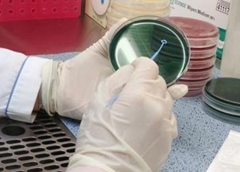 비브리오패혈증균 실험 검사